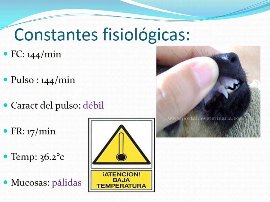 Fractura de la Bveda Craneal y Trauma Craneoenceflico